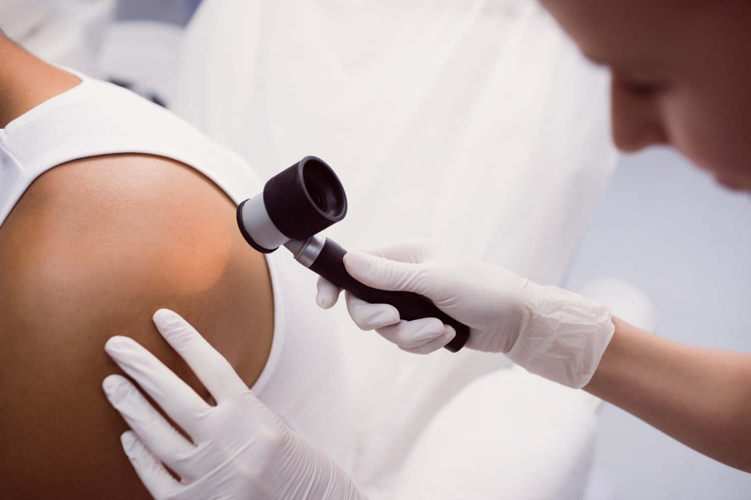 Dermatoskopia i wideodermatoskopia